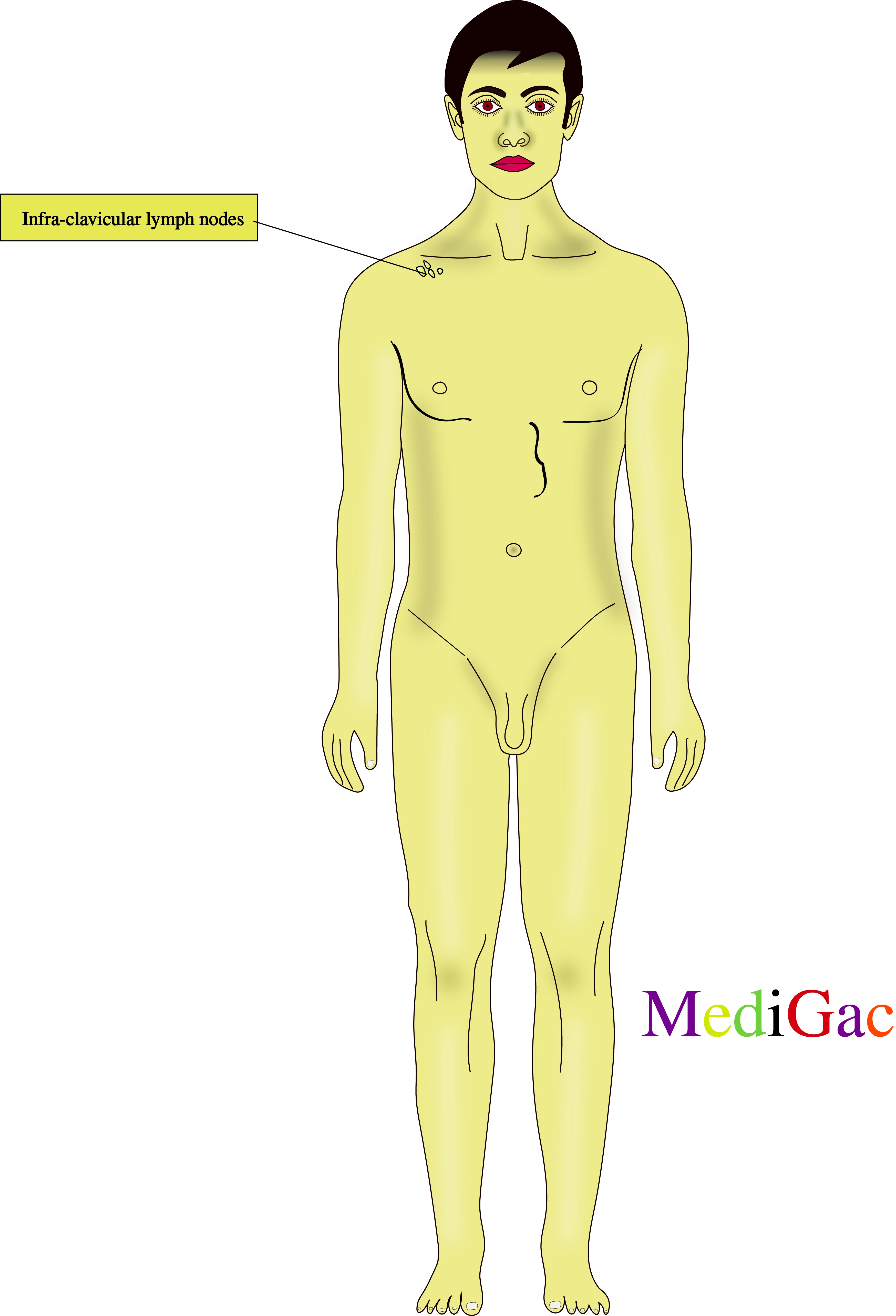 Infra clavicular lymph nodes